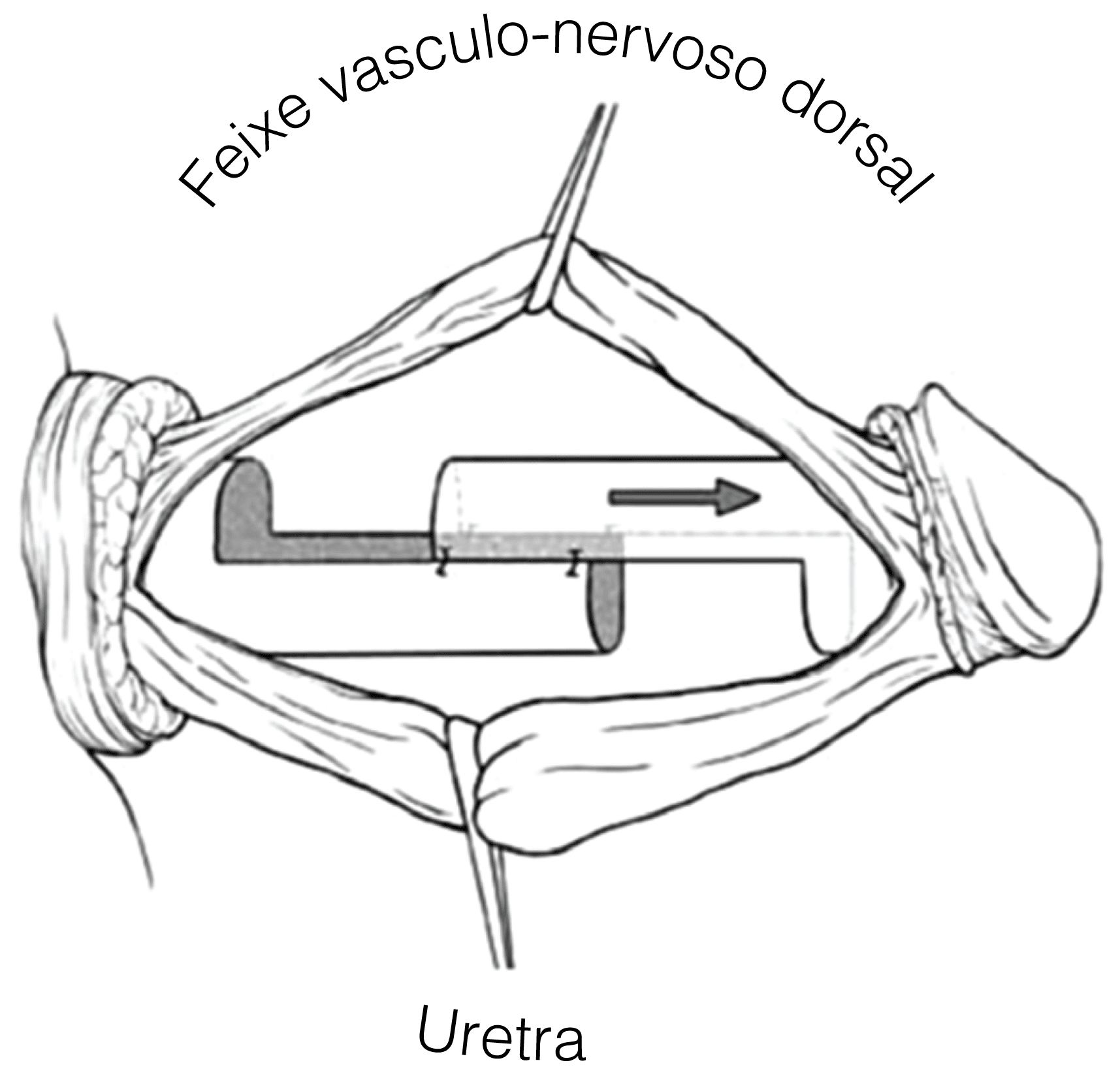 Prótese Peniana Dr. Alexandre Miranda / Andrologia & Urologia