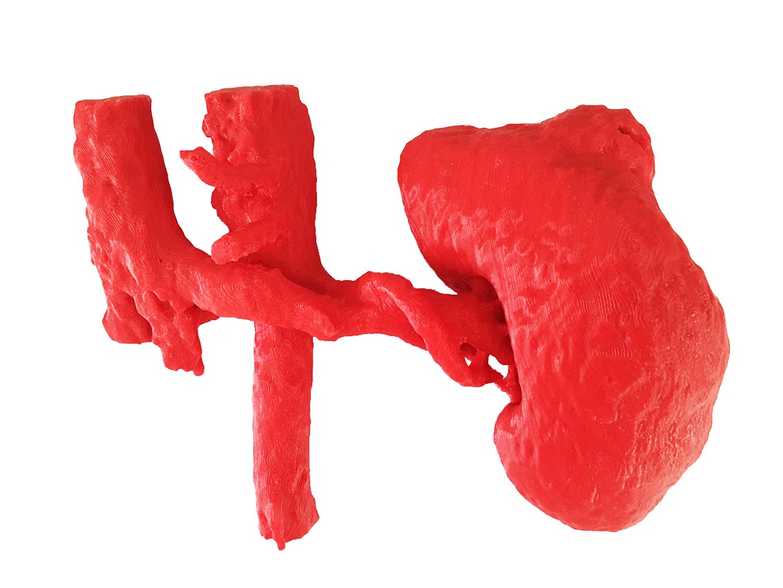 Foto de Conceito De Cirurgia De Rim 3d Renderização Isolado No