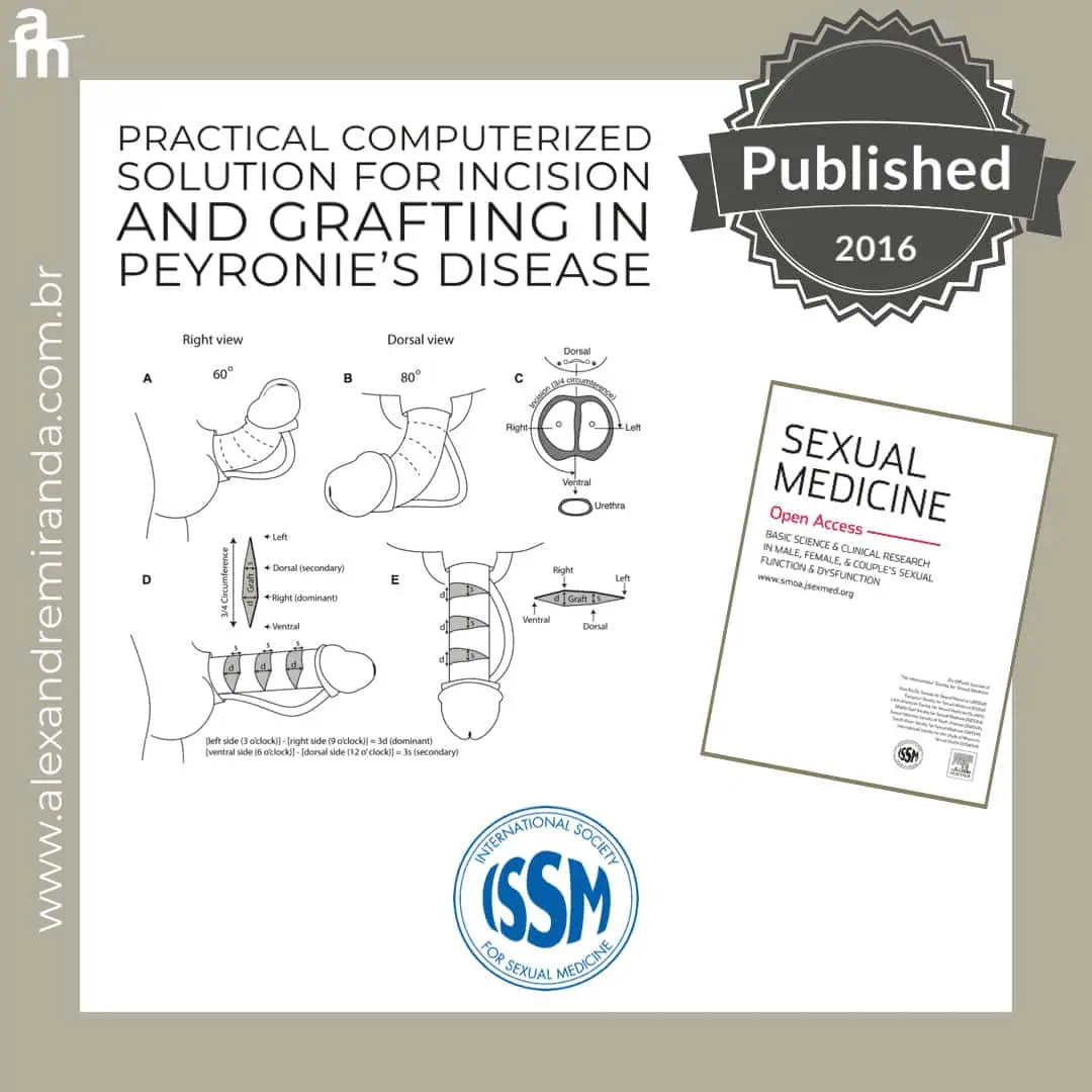 Procedimento cirúrgico para doenças de Peyronie em ilustração médica.